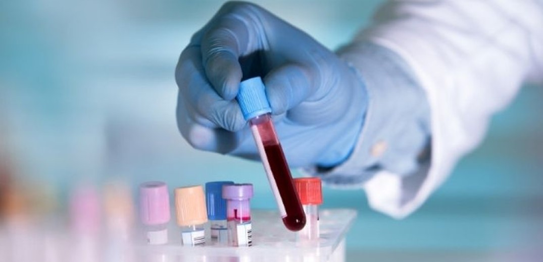 Καρκίνος: Νέο τεστ αίματος δίνει ελπίδα για ανίχνευση σε όσους δεν έχουν συγκεκριμένα συμπτώματα