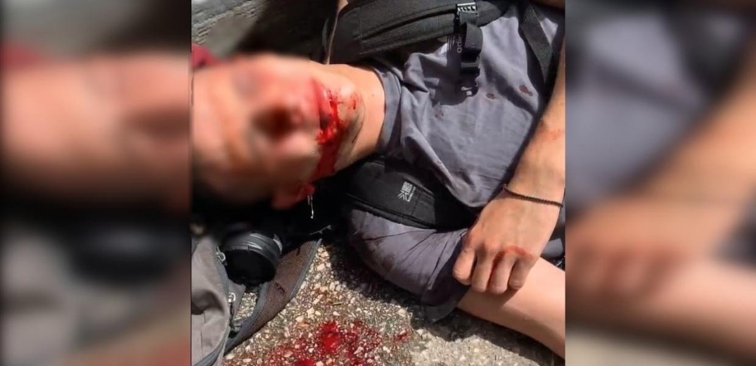 Θεσσαλονίκη: Μήνυση για απόπειρα ανθρωποκτονίας υπέβαλε ο φοιτητής που τραυματίστηκε στο ΑΠΘ