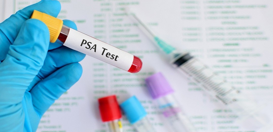Δωρεάν εξέταση PSA για την καλύτερη αντιμετώπιση των παθήσεων του προστάτη