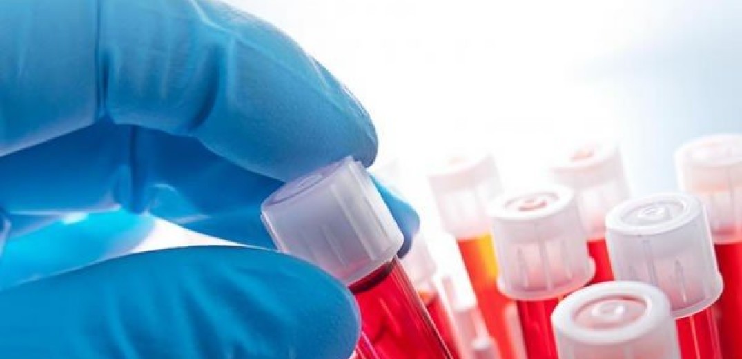Εξετάσεις αίματος μπορούν να προσδιορίσουν με ακρίβεια τους ασθενείς με long Covid
