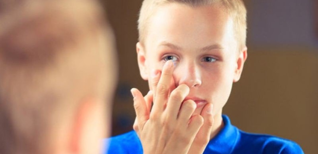 Οι πολυεστιακοί φακοί επαφής επιβραδύνουν την εξέλιξη της μυωπίας στα παιδιά