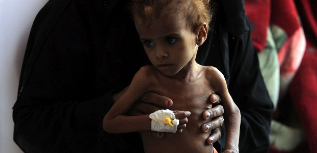 ΟΗΕ: Η Υεμένη μπορεί να αντιμετωπίσει τον χειρότερο λιμό στην ιστορία του πλανήτη